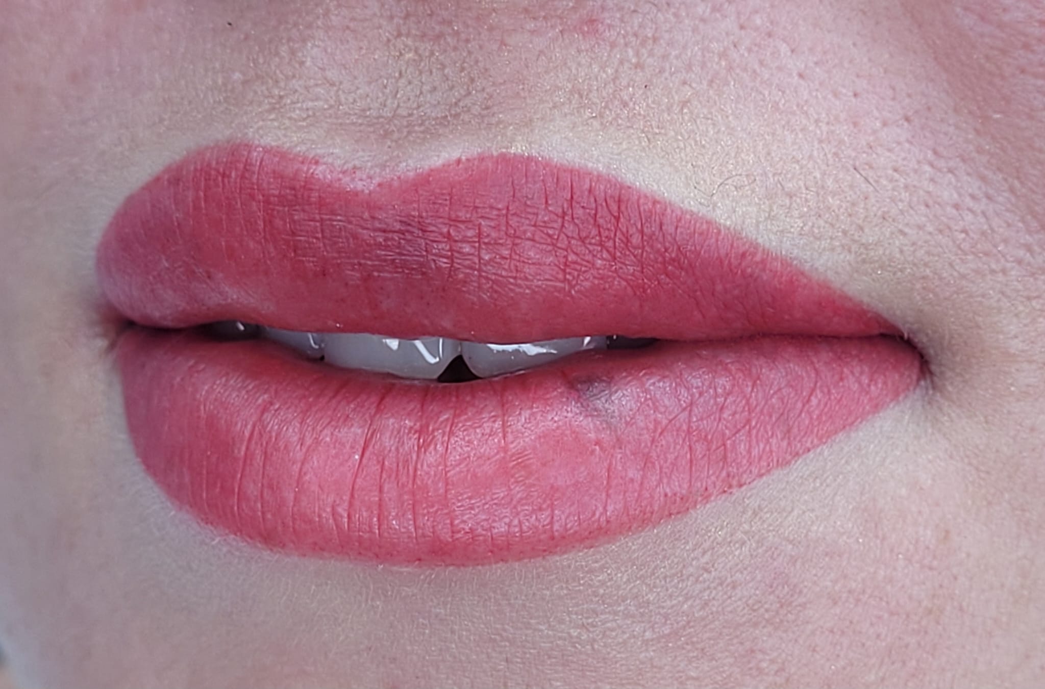 Lippen